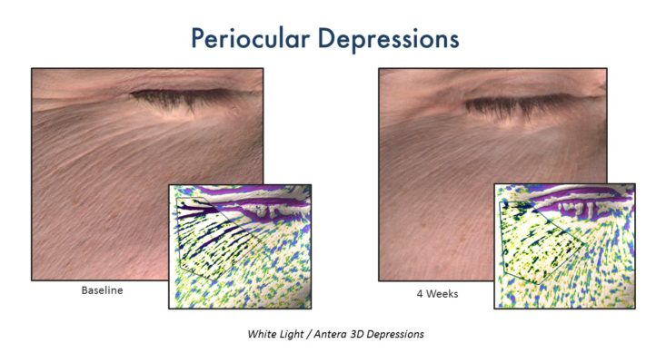 CerumWORX results fine lines